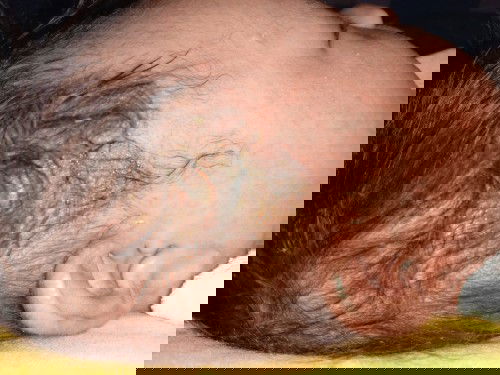 Kulit kepala bayi berkerak