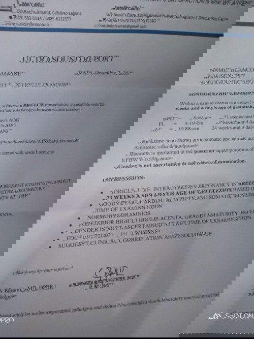 Ano po ba posisyon ng baby pagsuhi ? Kasi suhi daw baby ko kaya di nkita gender 😞