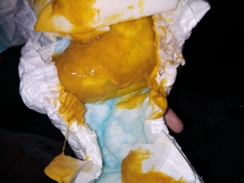 Baby's Poop