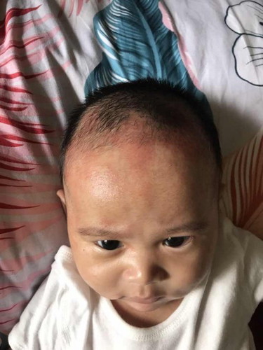 rashes/redness on my 3month old baby