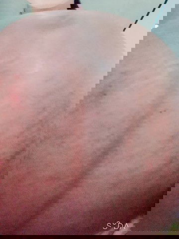 Ask ko lang po, may alam po ba kayong effective way or medicine for strech marks habang pregnant? ty