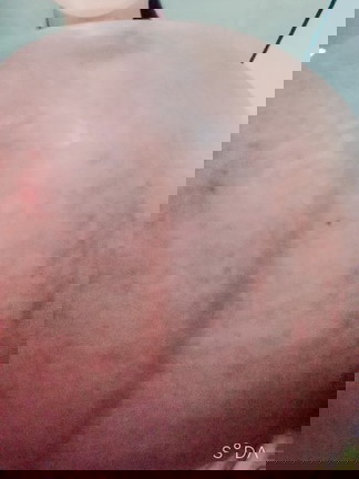 Ask ko lang po, may alam po ba kayong effective way or medicine for strech marks habang pregnant? ty