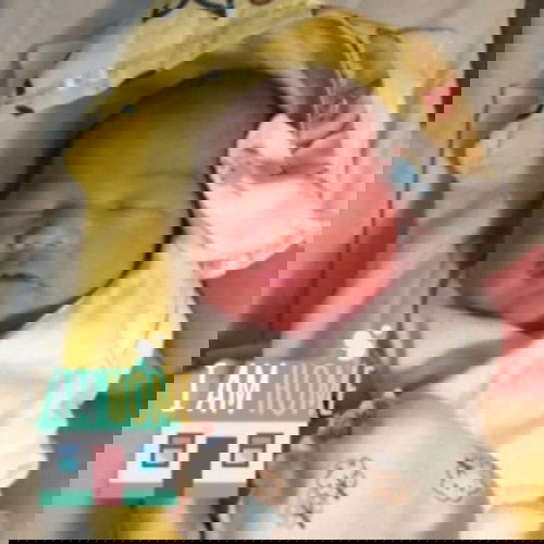 Baby's Out @36 weeks