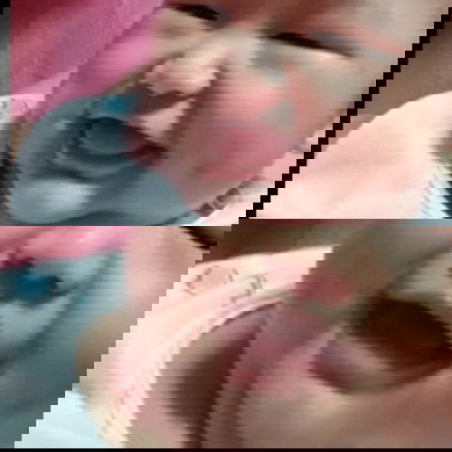 SINO PO NAKAEXPERIENCE SA BABY NILA NA MAY DIMPLES PERO NUNG TUMAGAL NAWALA DIN PO?