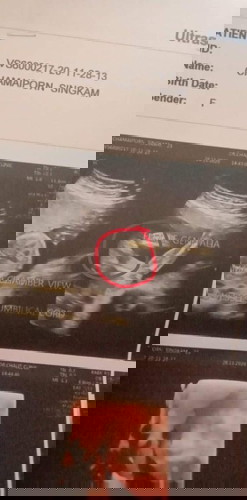 ซาวตอน4เดือนกว่าๆ