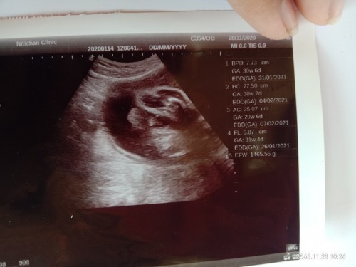 ดูให้หน่อยจร้า