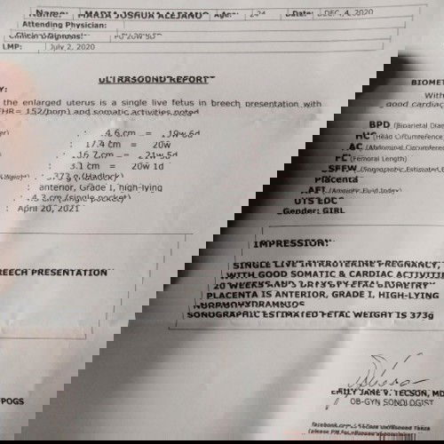 #teamApril
#confused
#GenderGirl 20weeks and 5days may posibilidad po ba na mali yong ultrasound ko