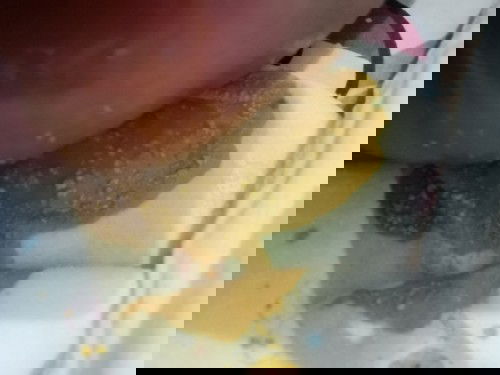 อึเเบบนี้ปกติไหม