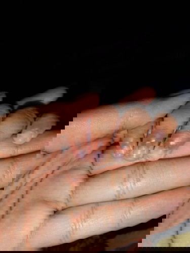 โคนเล็บลอก