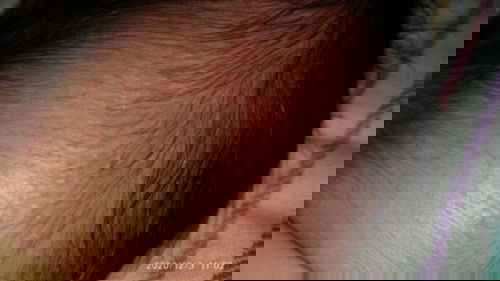 Bentol2 Dikepala Bayi.