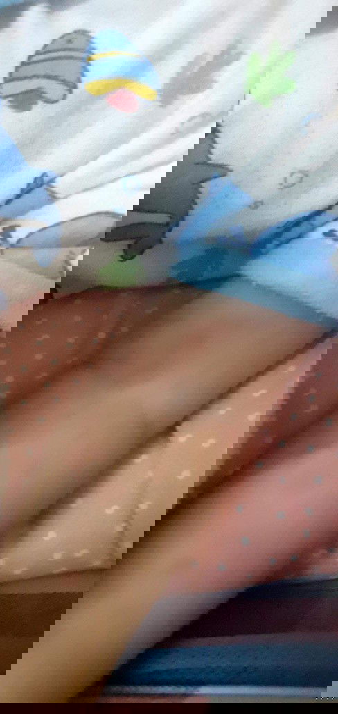 น้องมีผื่นขึ้นค่ะ