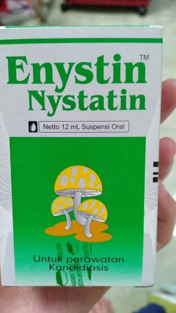 Sariawan di sudut bibir.