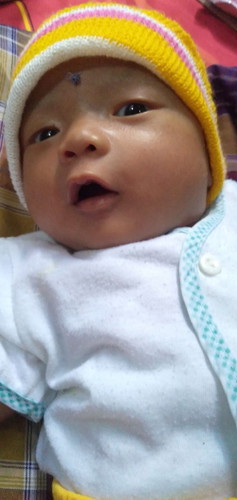 Bayi batuk n pilek