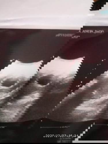 Bagaimana keadaan janin saya