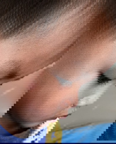 เกลื้อนหรืออะไร