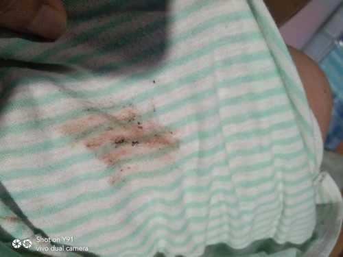 Something like bleed in my panty