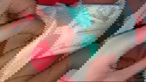 เหมือนสะดือน้องหลุดไม่หมด