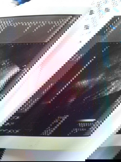 G mn  hasil usg saya karna pas usg sama bidan. Bukan dokter