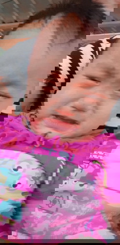 กระหม่อมลูกยังไม่แข็งรึยังไม่หายอ่อนบุบ