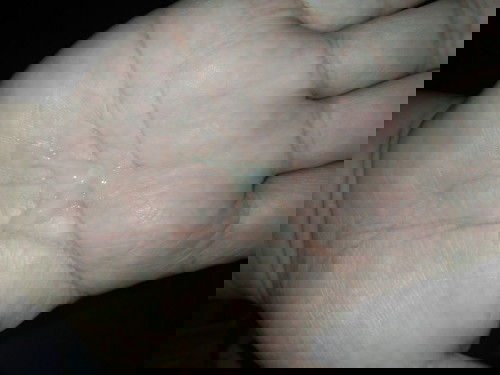 เมือกหรือตกขาวคะ