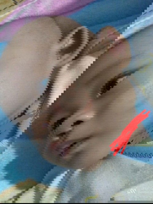 Ringworm atau bukan?