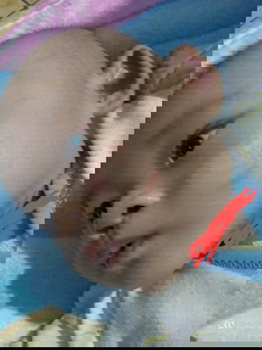 Ringworm atau bukan?