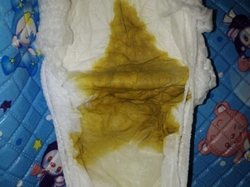 Fases bayi minum sufor