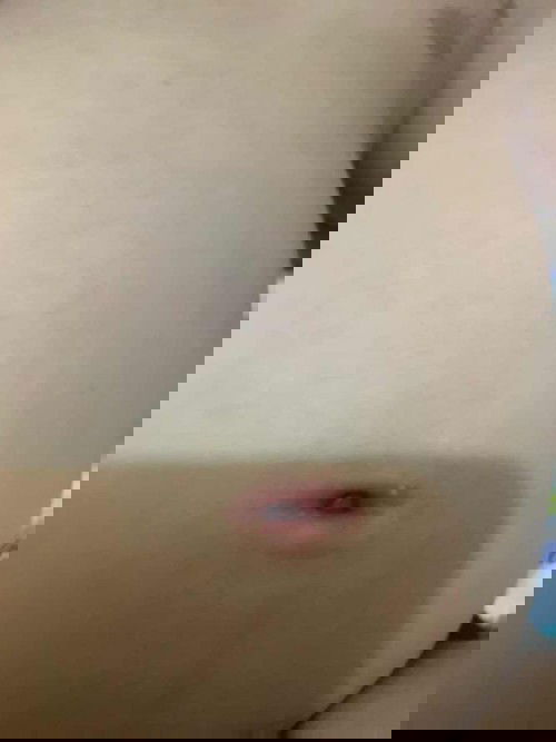 Pusar merah dan terkadang bau tidak sedap