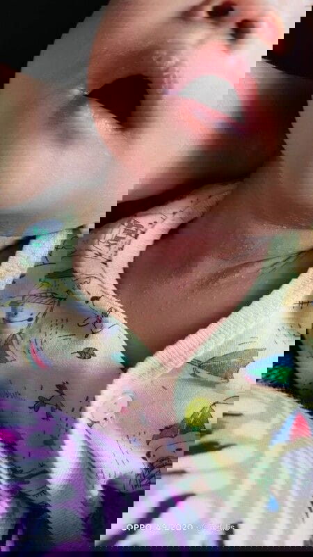 Bund bund mau nanya apakah ini biang keringat?atau apa?sharing obatnya ya..