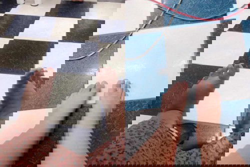 ครรภ์เป็นพิษ ผ่าฉุกเฉิน