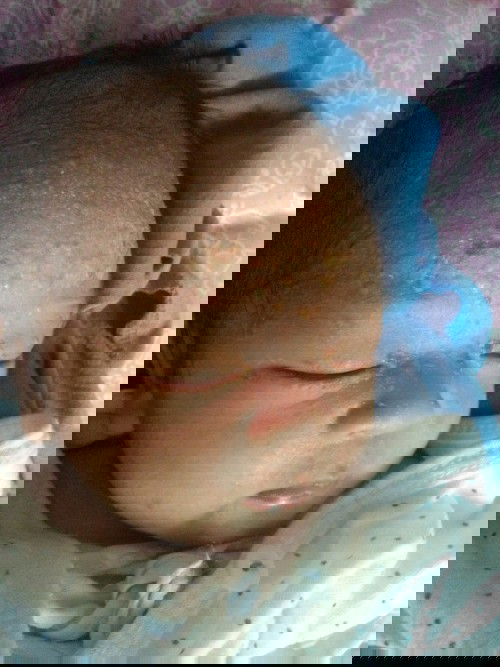 Bunda2 share pengalamannya dong..anak saya umur 7 hari timbul bercak2 benanah gitu...apa yah solusin