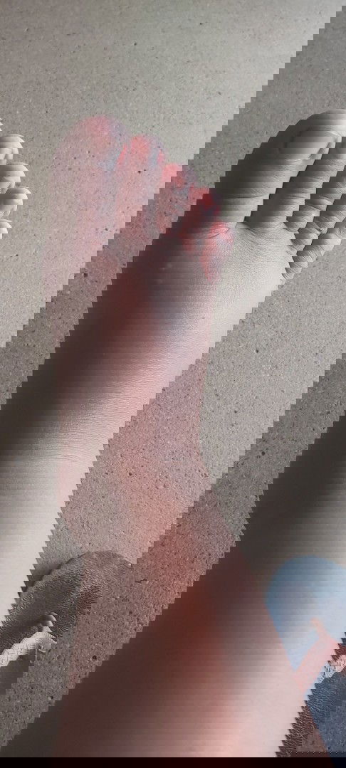 Kaki dan tangan pada bengkak