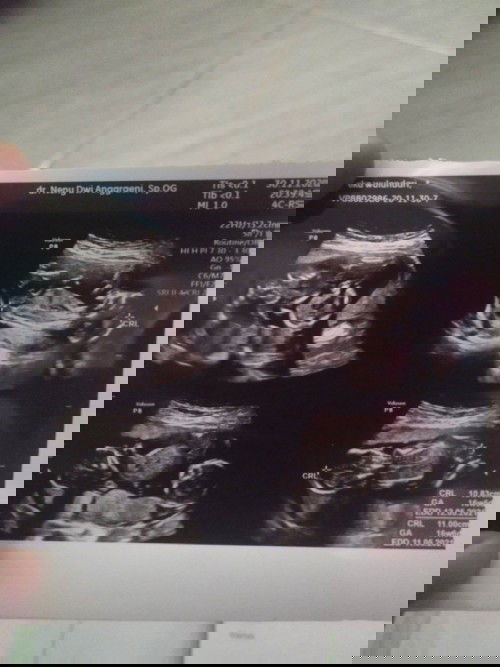 Mohon di jawab bund,