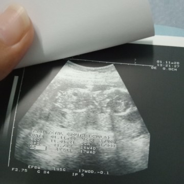 แม่ๆบ้านไหนได้น้อง ผช ช่วงคอนเฟิร์มหน่อยคะ