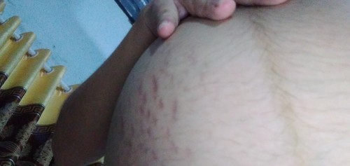 Làm sau trị rạng nức bụng vậy mọi người