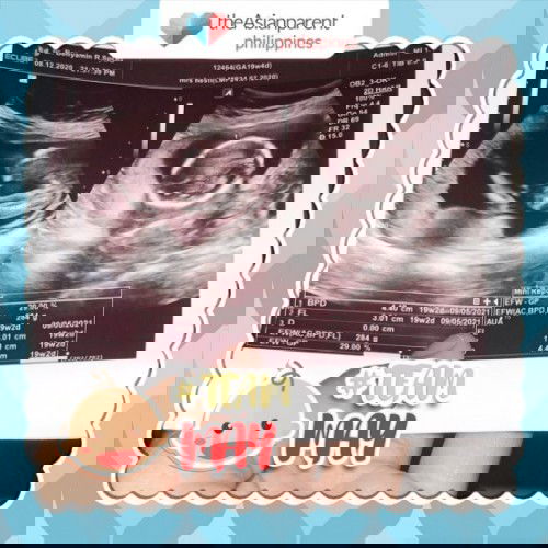 Usg anak saya malam tadi