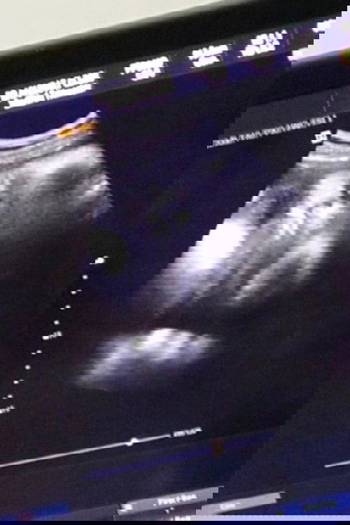 ตั้งครรภ์ได้39+2W ซาวนน.ตัวลูกได้3500gตัวใหญ่ไปไหมค่ะ