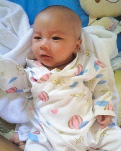 คลอดก่อนกำหนด