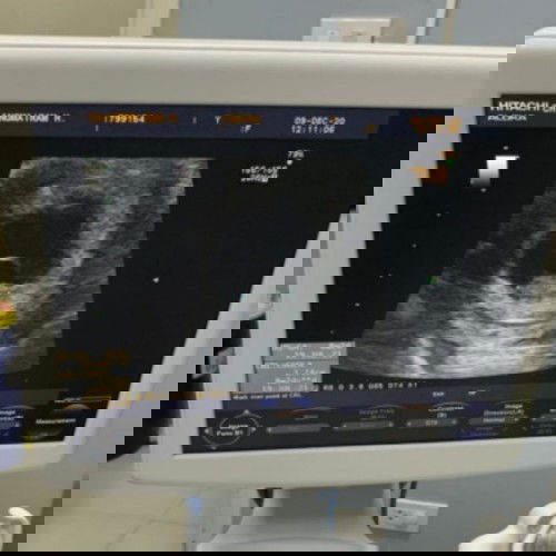 คุณแม่+เป็นพาหะมะเร็งปากมดลูก