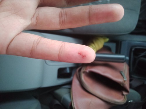 สอบถามก่อนคลอด