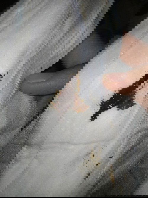 เลือดออกหลังกระตุ้นคลอด