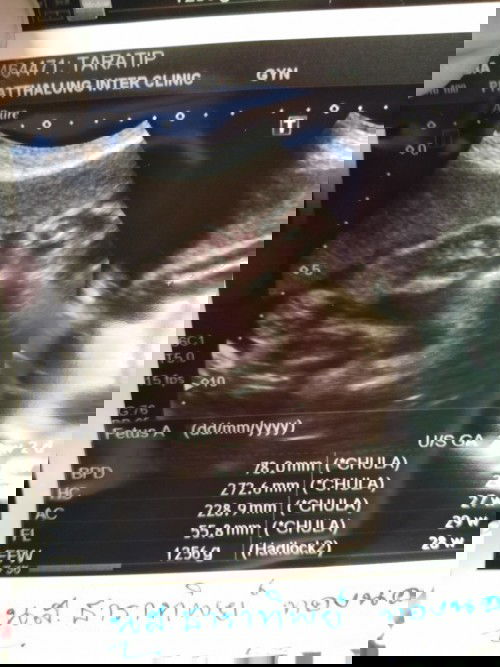 มาให้แม่ๆทายเล่นๆ