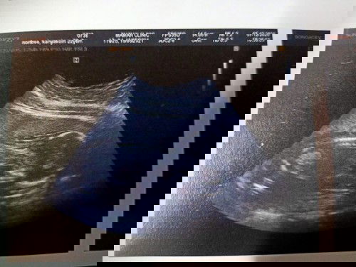 อัตราซาวด์ครั้งแรกคะ