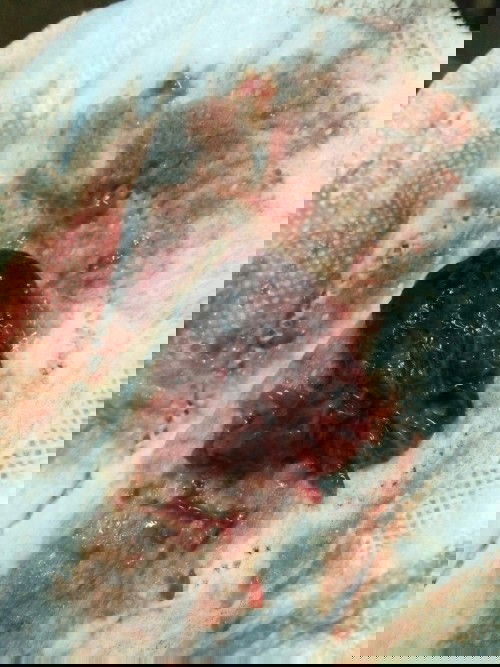 ผ่าคลอดได้12วัน มีลิ่มเลือดออกมาแบบนี้ปกติไม่คะ