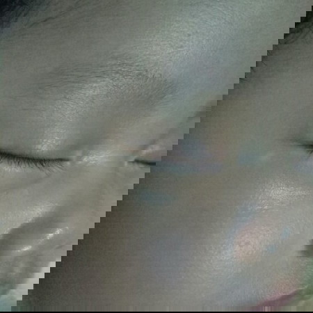 bercak putih dibagian kelopak mata..