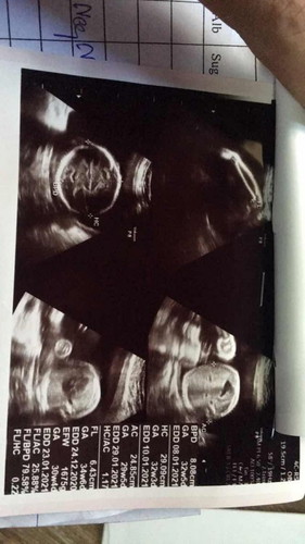 ขอกำลังใจหน่อยค่ะแม่ๆตอนนี้เคลียดมากเสียใจมากๆค่ะ