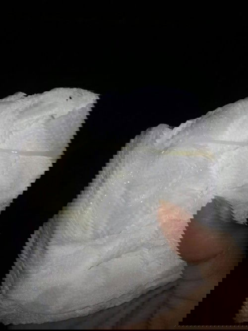 มีมูกแบบนี้ออกใกล้คลอดยังคะ38+2