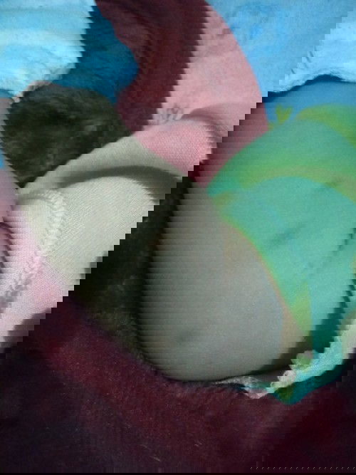 Penghilang bekas gigitan serangga