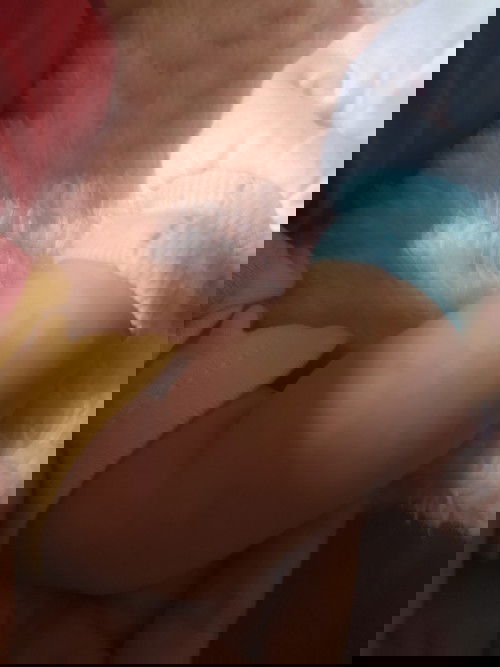 kulit bayi menjadi belang