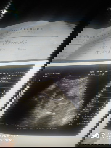 Dok kan hitungan dari lambat nya bulan 12 minggu.Tpi kmarin saya periksa lg di usg katanya 13 minggu
